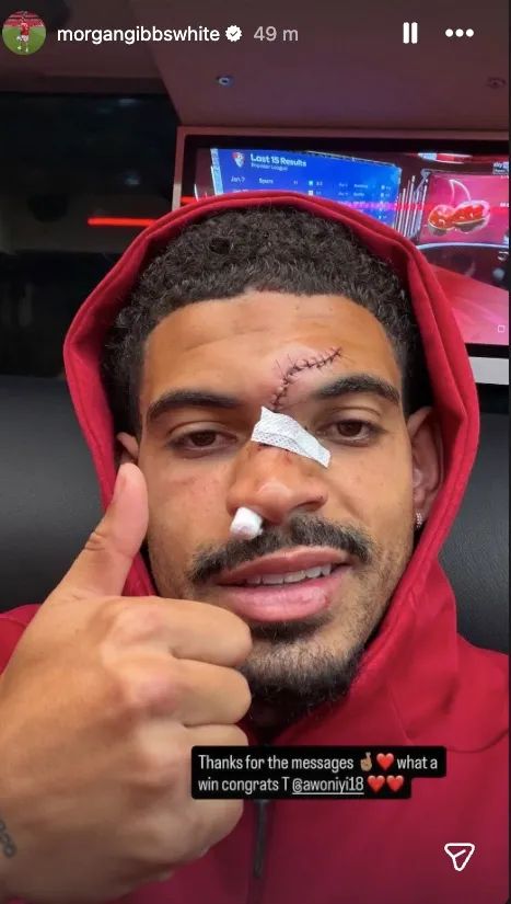 Morgan Gibbs-White selfie showing facial injuries and stitches after a match, giving a thumbs up.