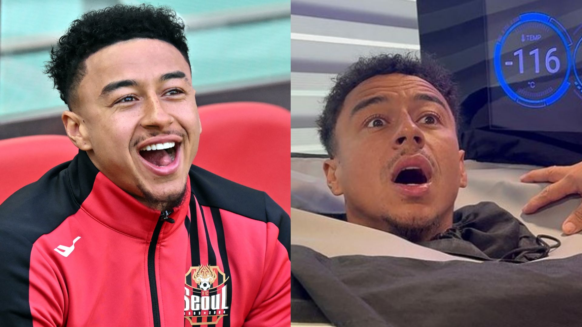 Jesse Lingard cryo 2024