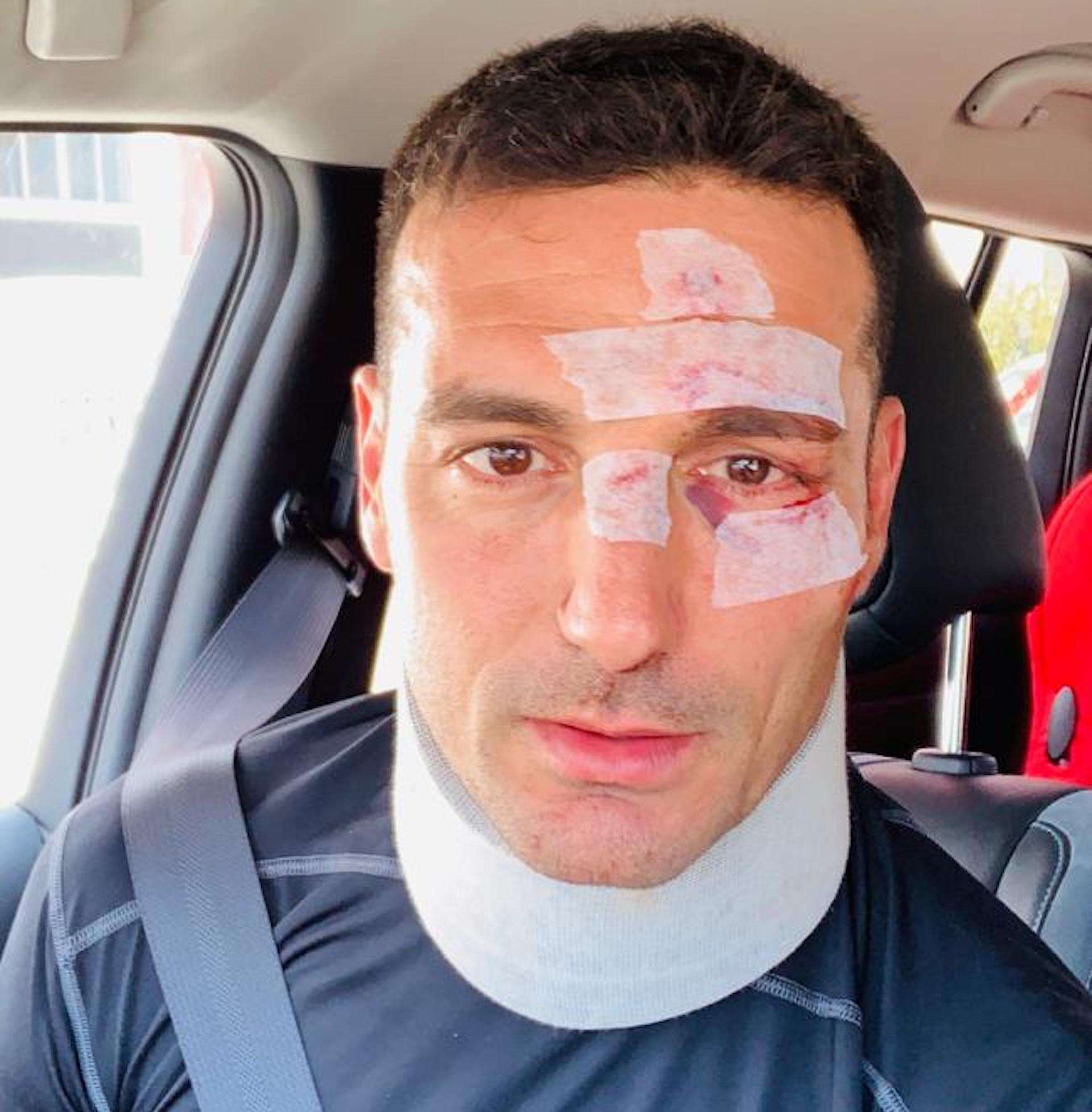 Lionel Scaloni accidente