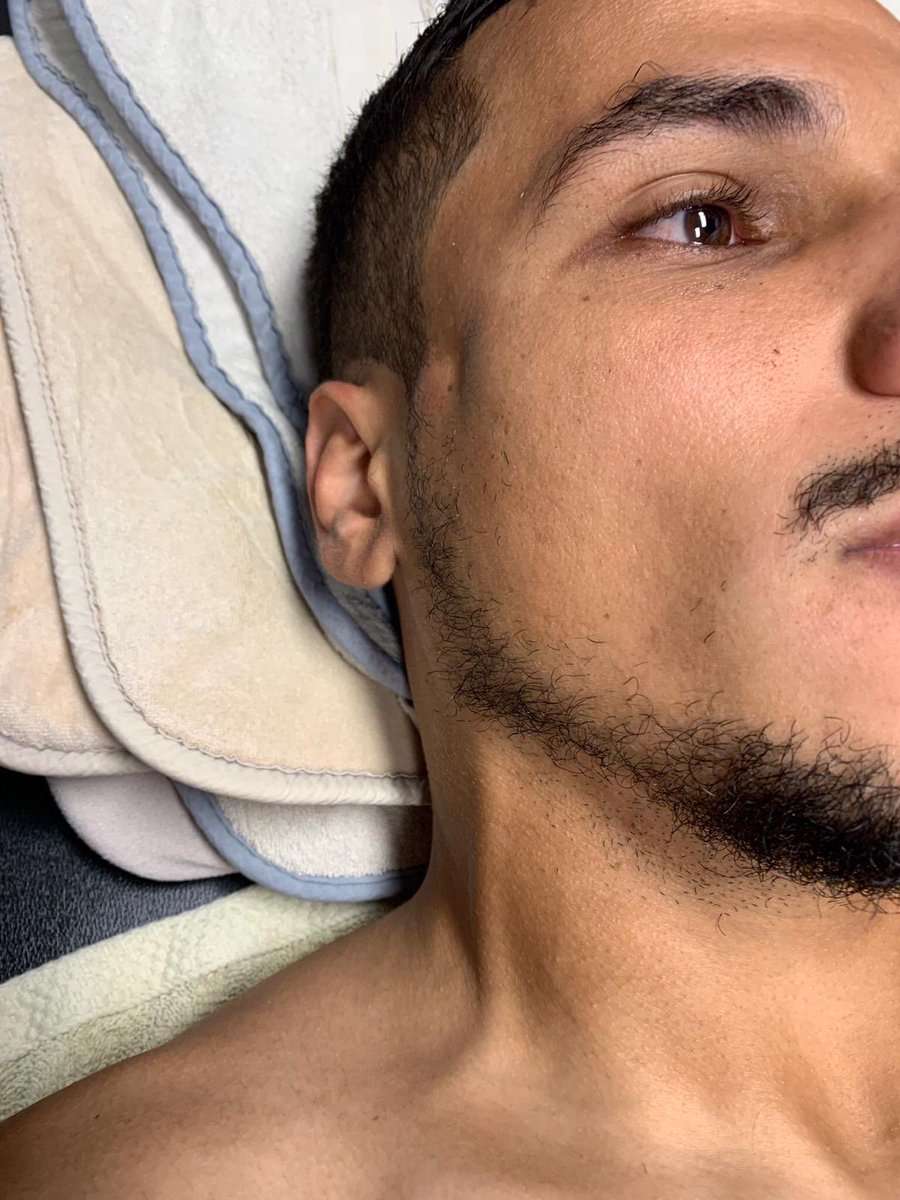 Mohamed El Munir LAFC injury