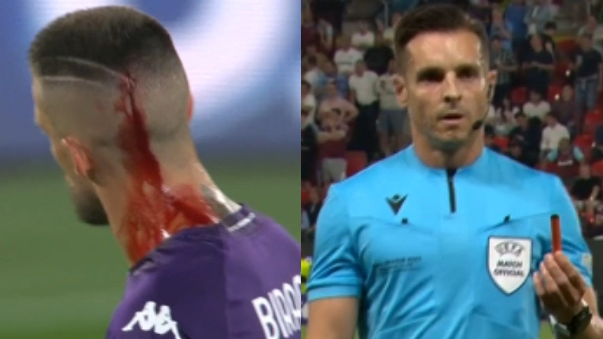 biraghi ferito alla testa