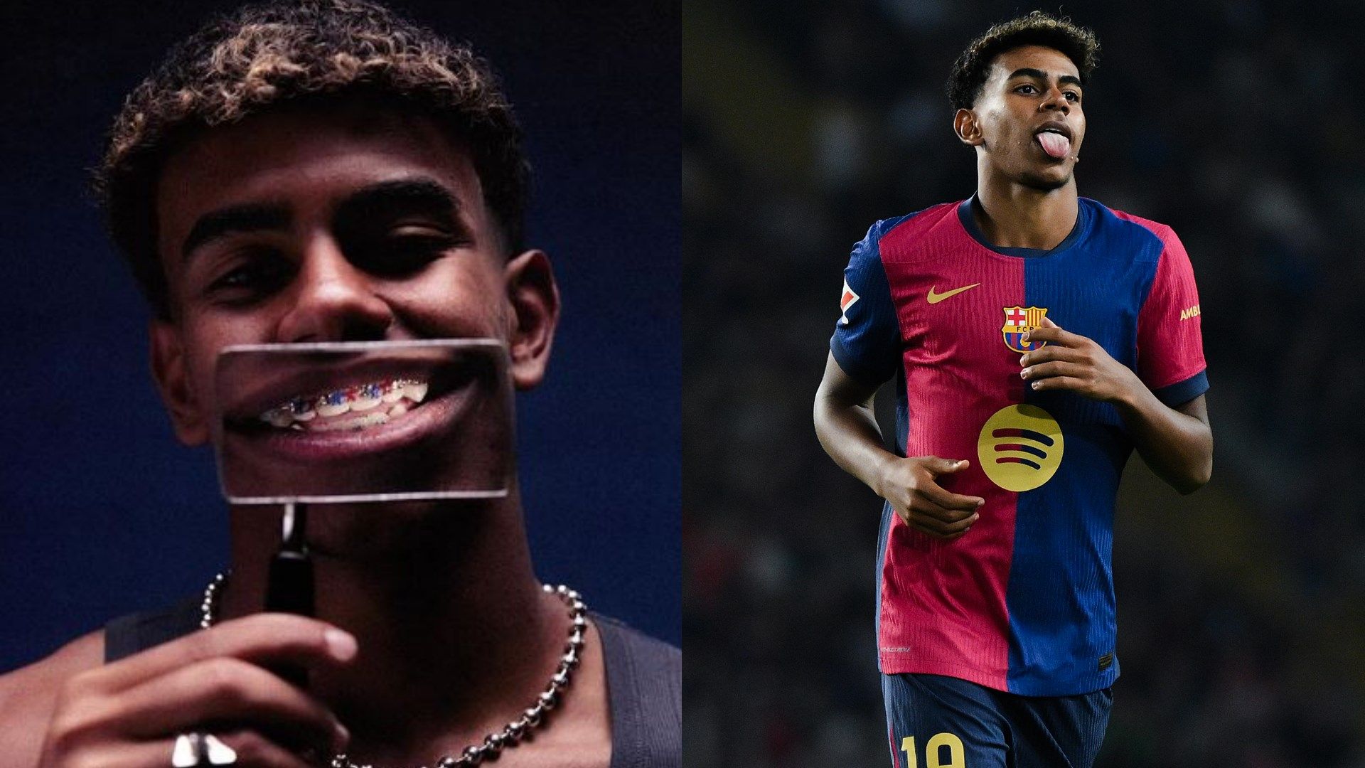 Lamine Yamal Zahnspange