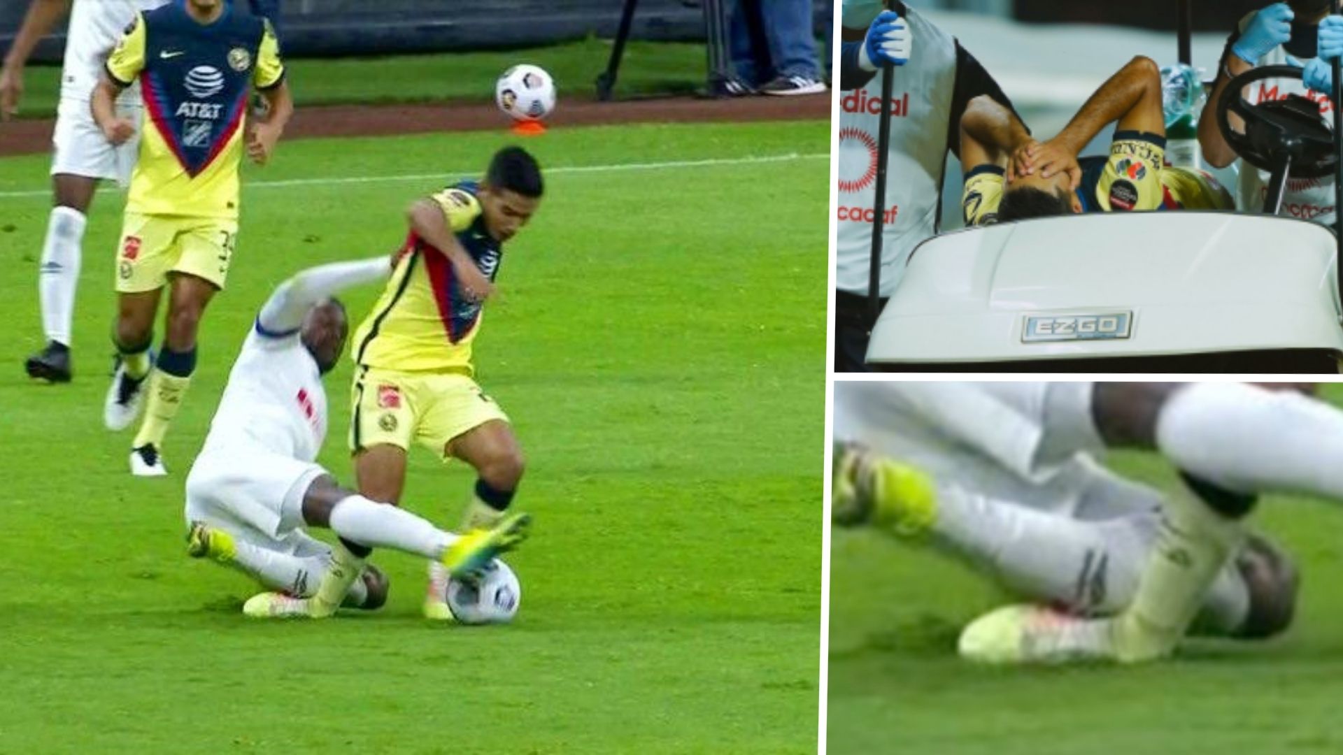 Lesión Chucho López América - Olimpia