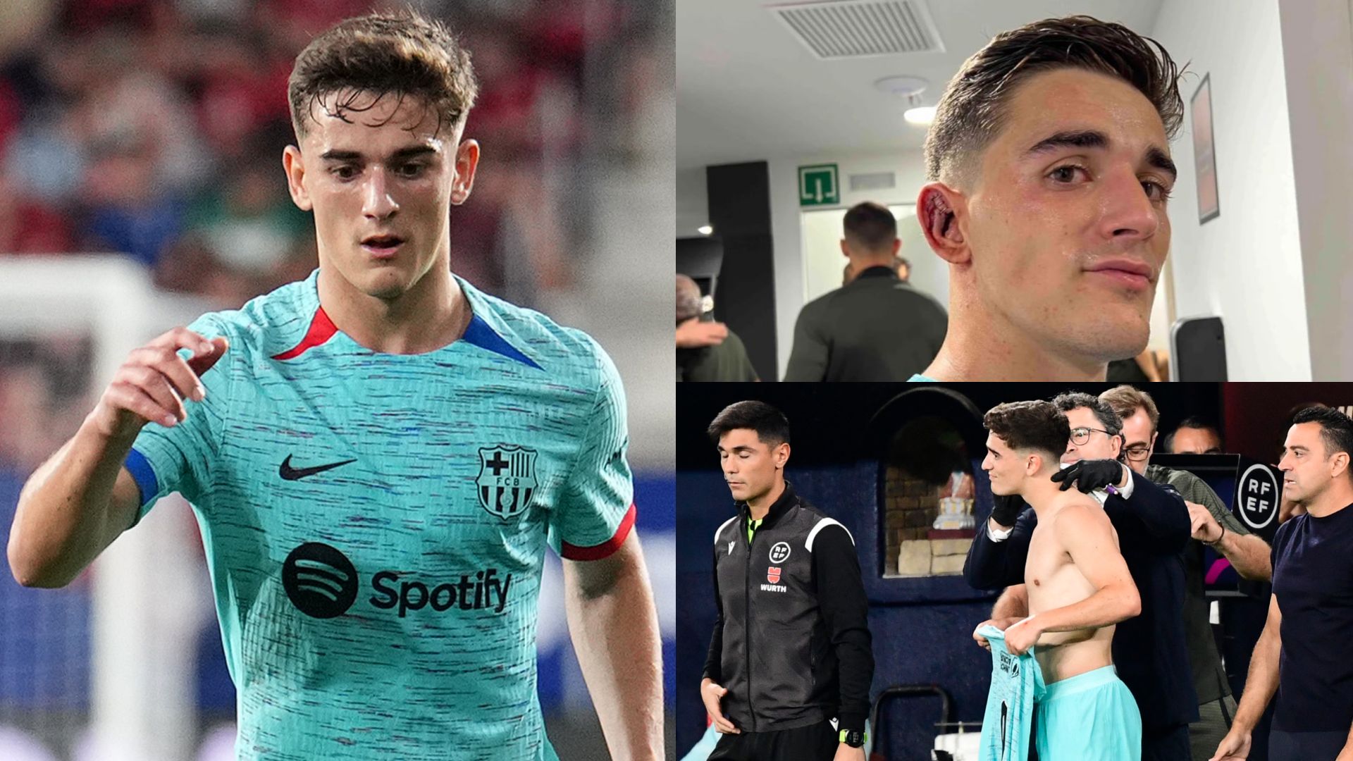 Gavi ear staples Barcelona 2023-24