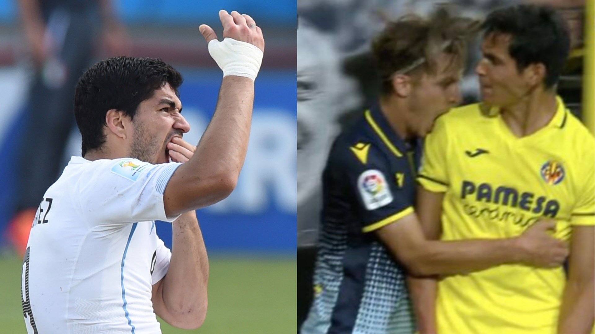 Luis Suarez, Aissa Mandi Bitten GFX