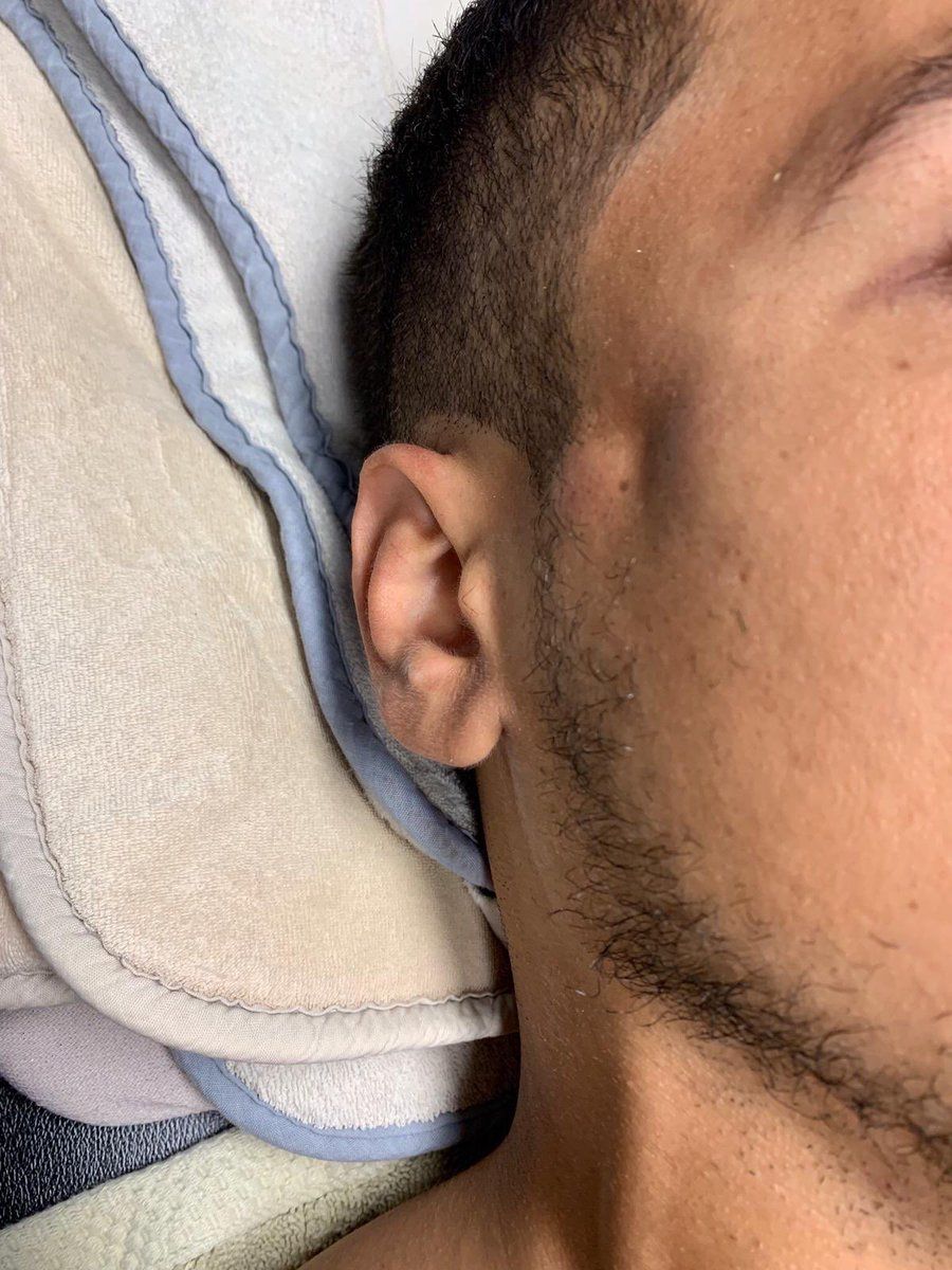 Mohamed El Munir LAFC injury