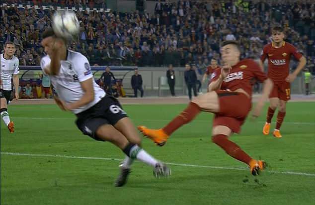 Mano de Arnold Roma - Liverpool