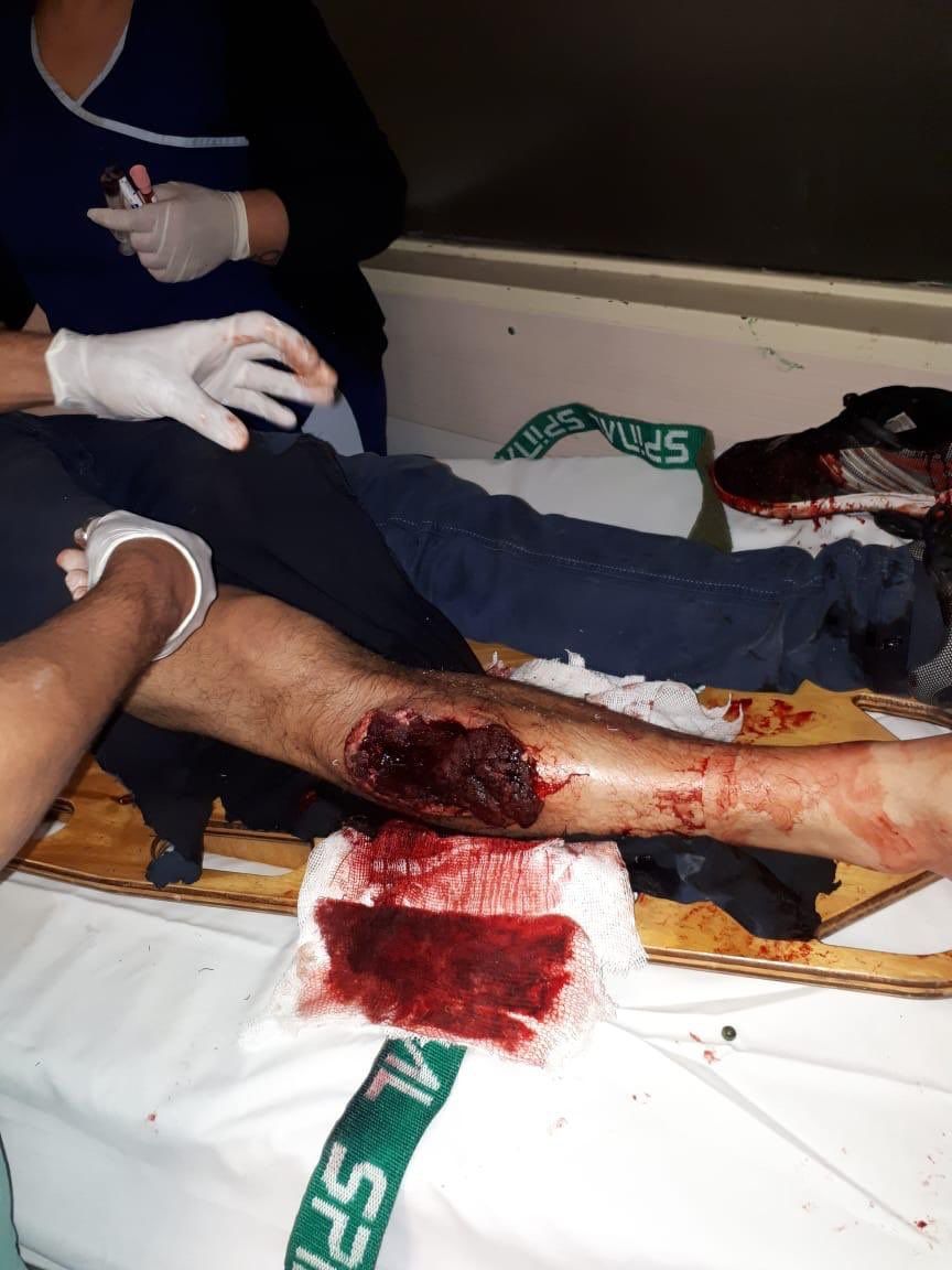 SIN CORTAR Gonzalo Primo Jonatan Maidana herido