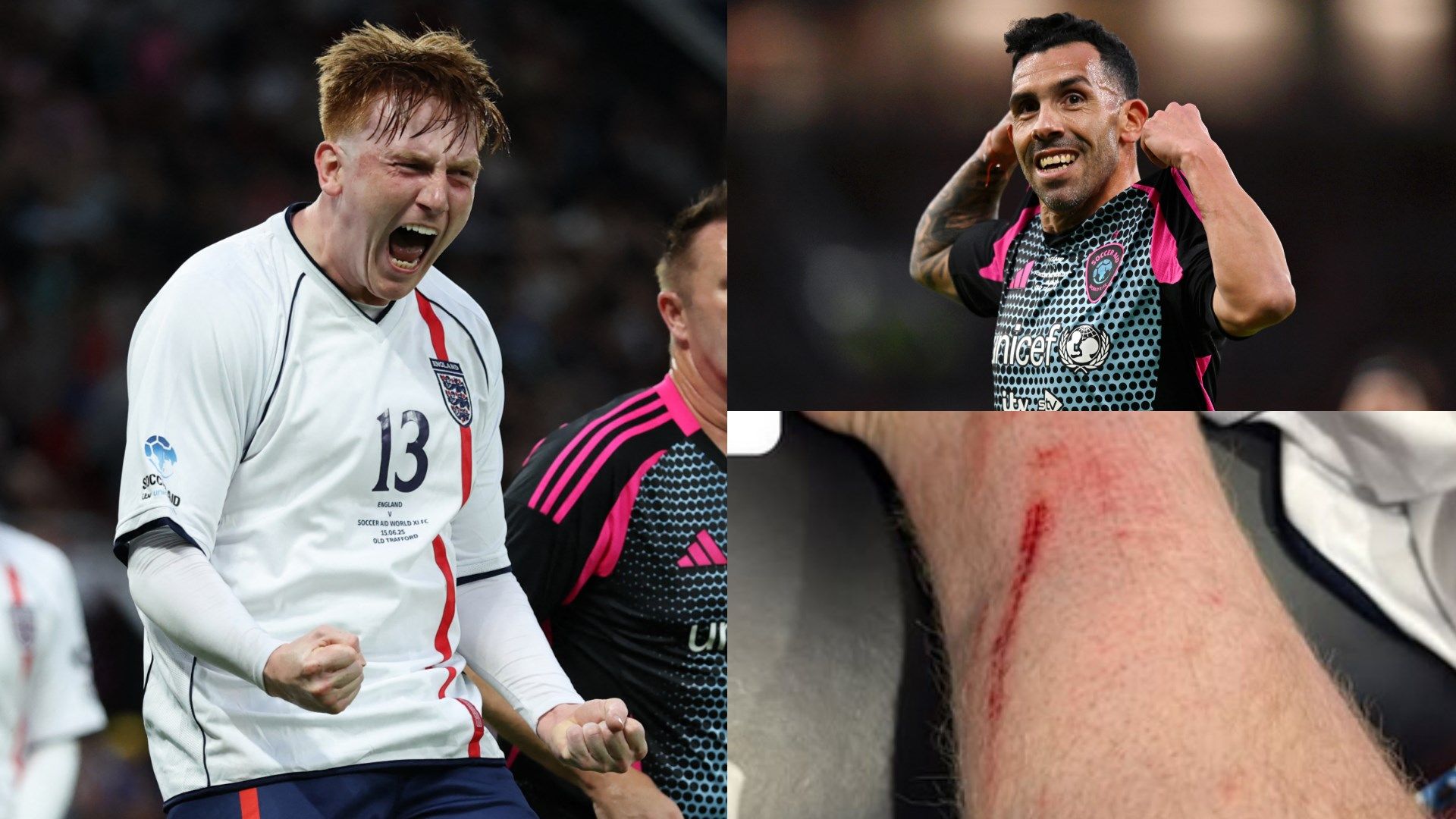 Carlos Tevez labelled a 'tw*t' by Angry Ginge as Soccer Aid clash with ex-Man Utd & Man City star leaves YouTuber with nasty injury | Goal.com UK