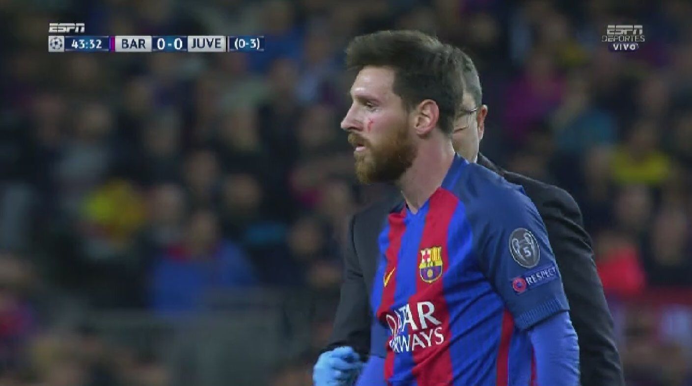 Messi sangre pomulo