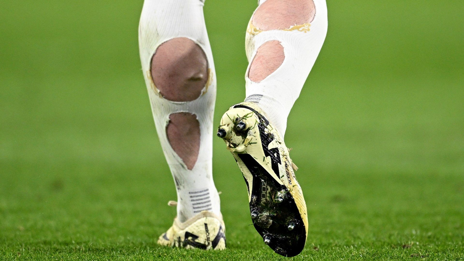 Conor Gallagher socks