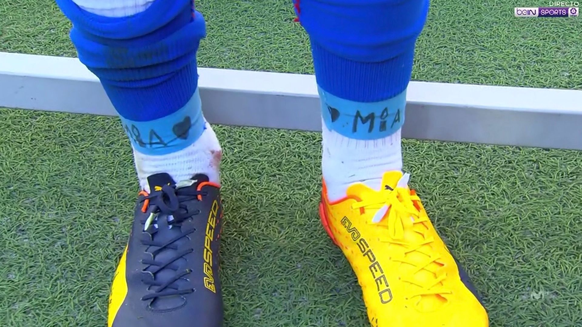 Antoine Griezmann tobilleras Mía Atlético Real Madrid LaLiga 08042017