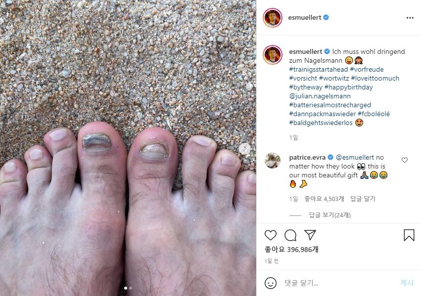 토마스 뮐러 발