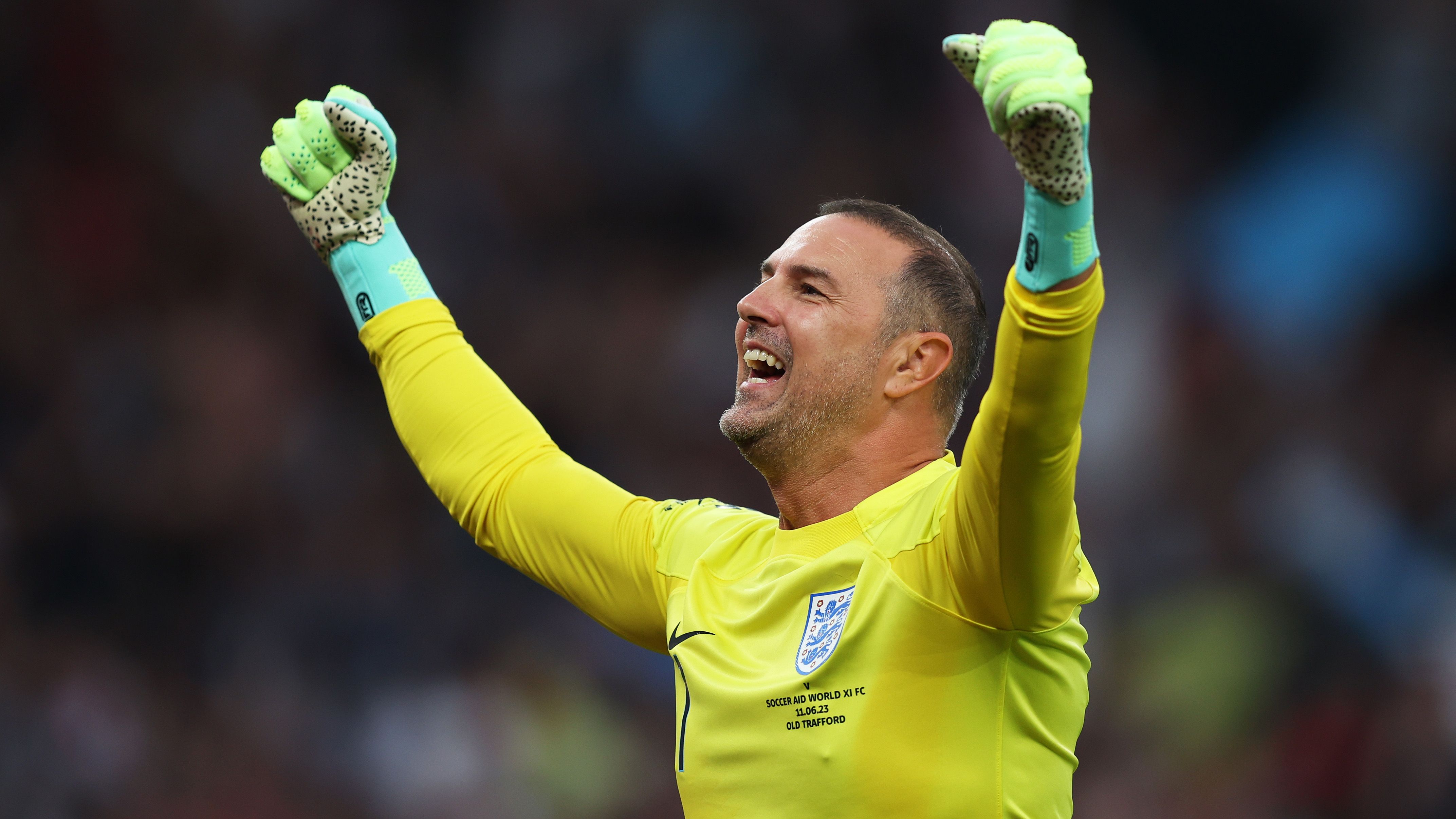 Joe Hart's new look: Ex-England No. 1 flaunts apparent hair