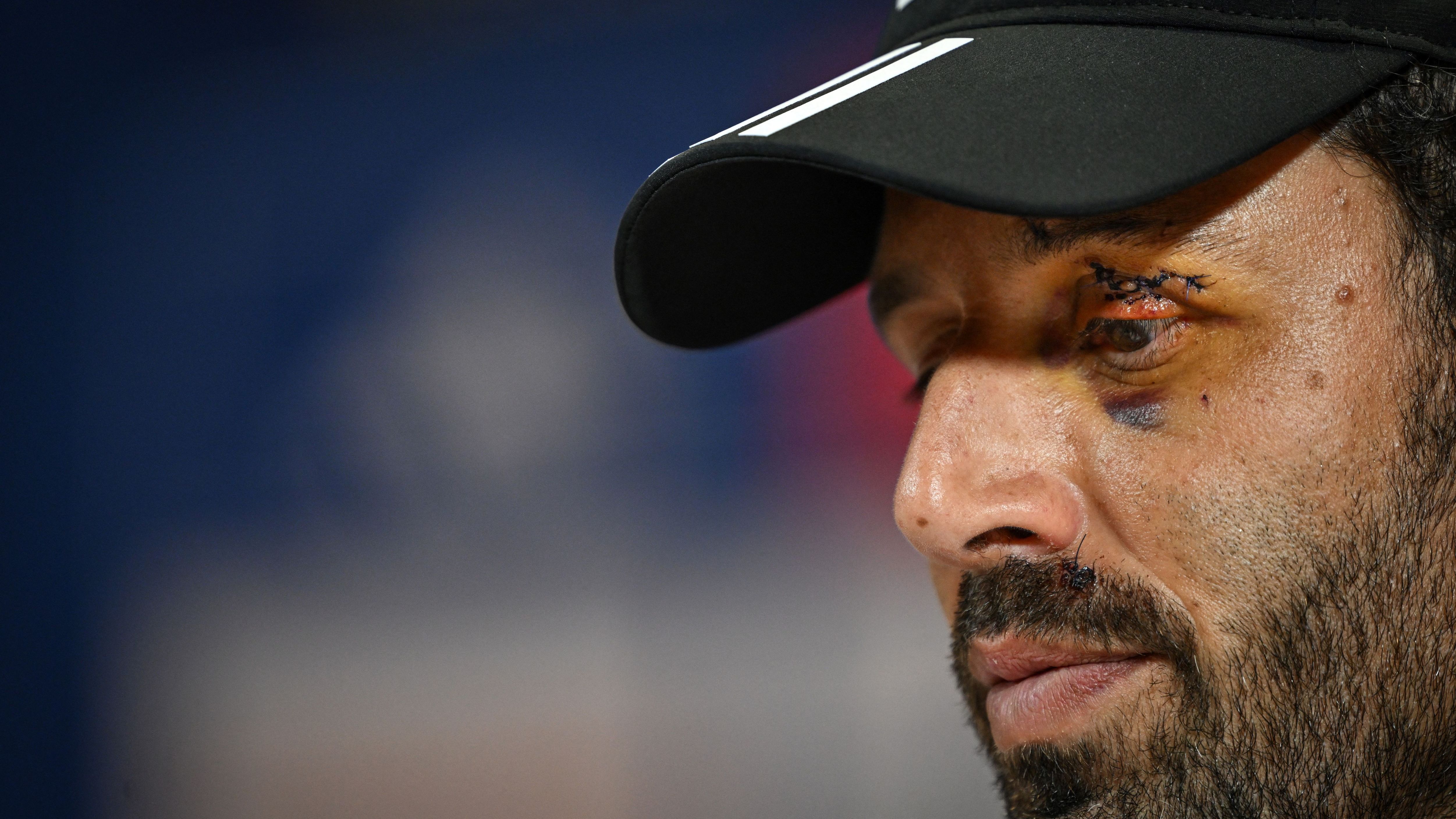 FBL-FRA-LIGUE-LYON-PRESSER