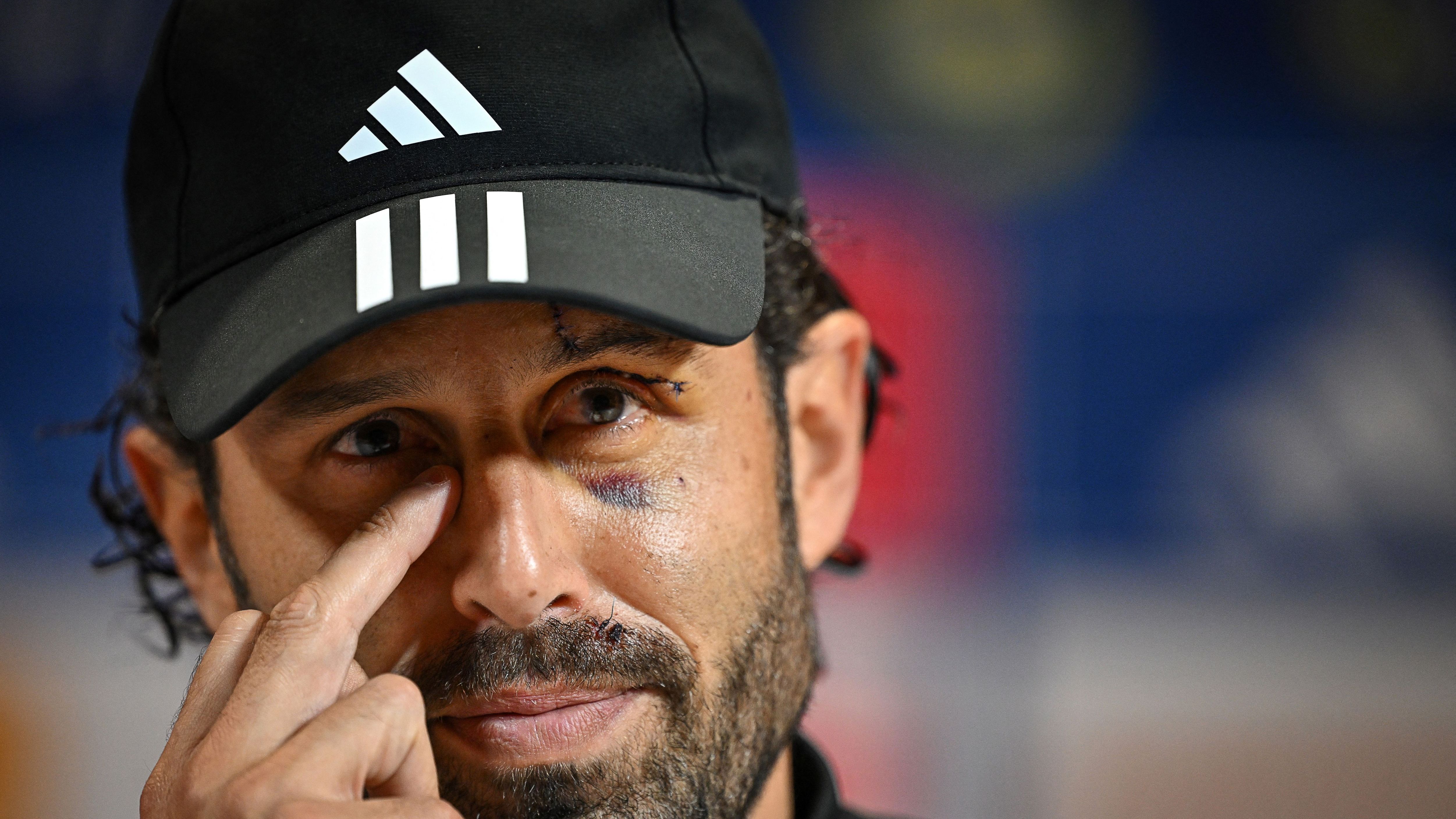 FBL-FRA-LIGUE1-LYON-PRESSER