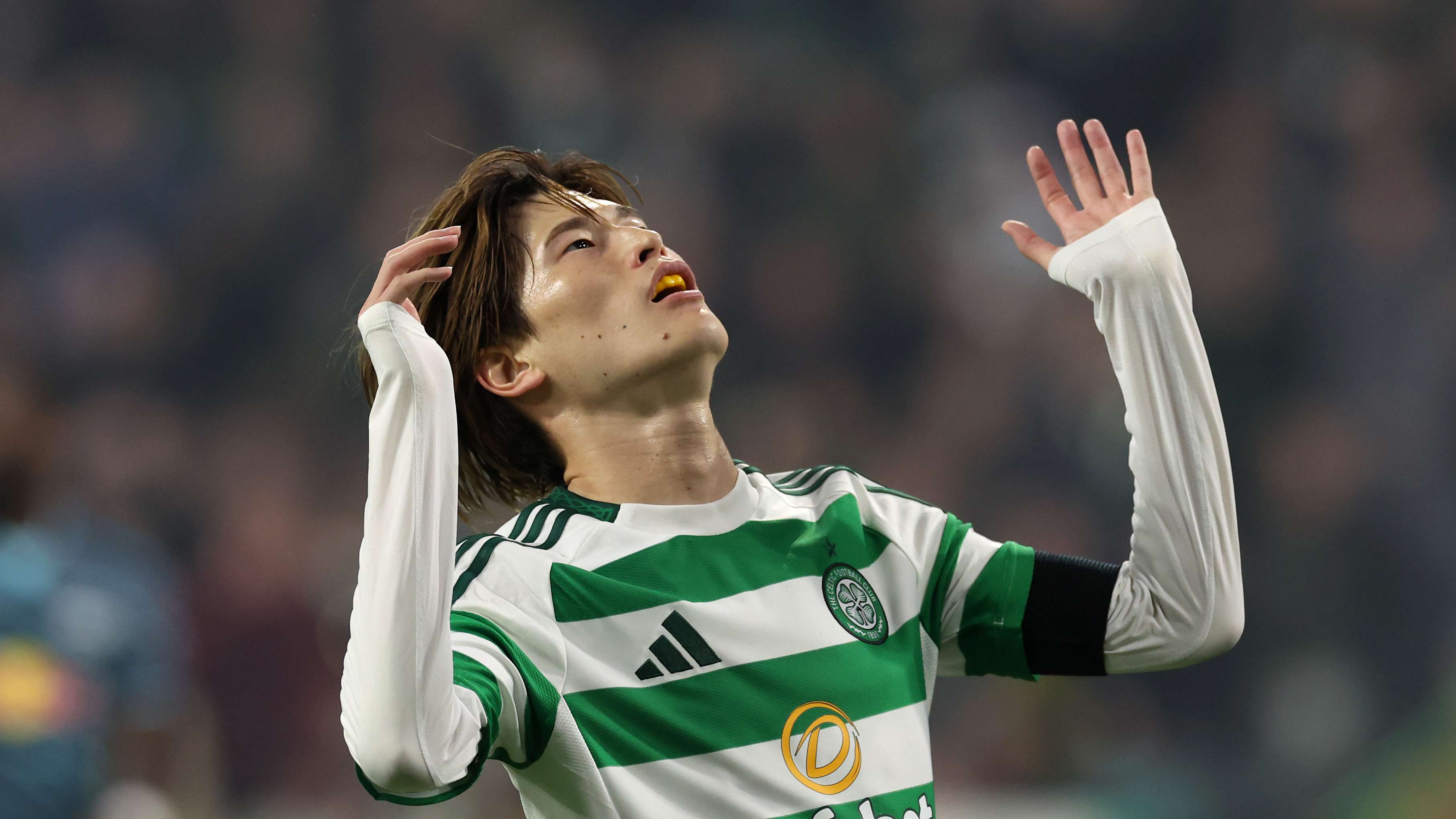 Celtic FC v RB Leipzig - UEFA Champions League 2024/25 League Phase MD4