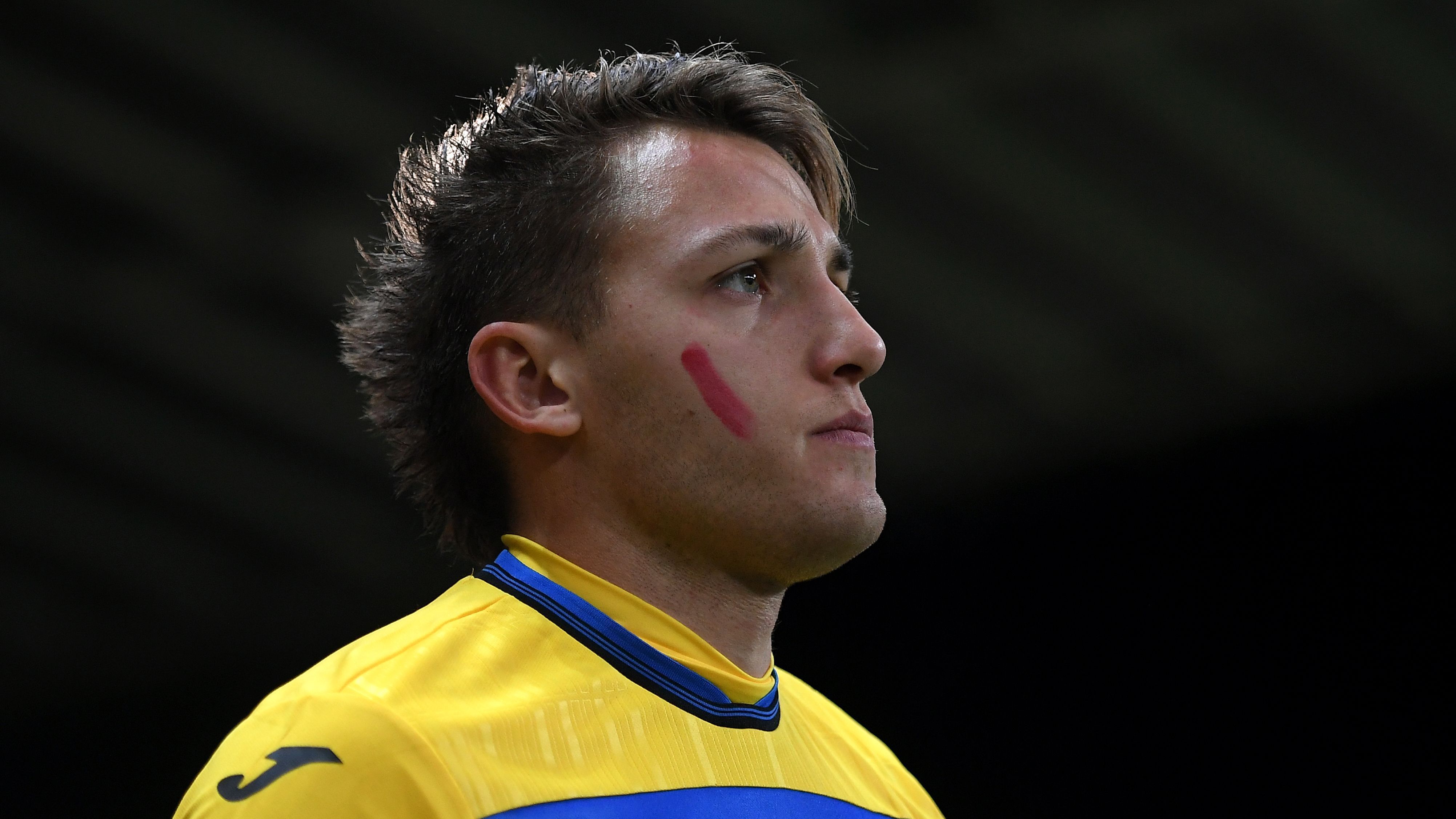 Parma v Atalanta - Serie A