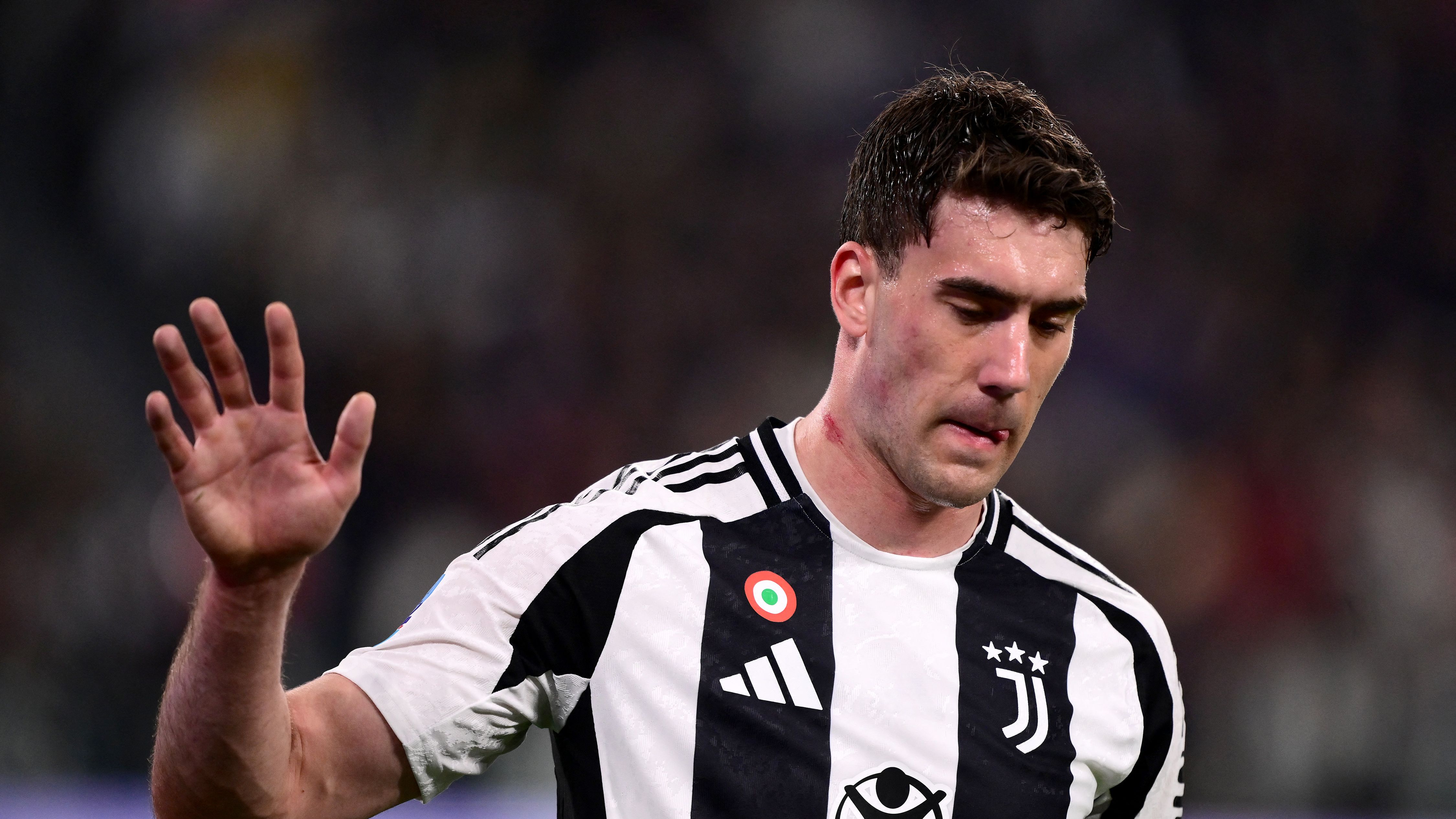 FBL-ITA-SERIE A-JUVENTUS-LECCE