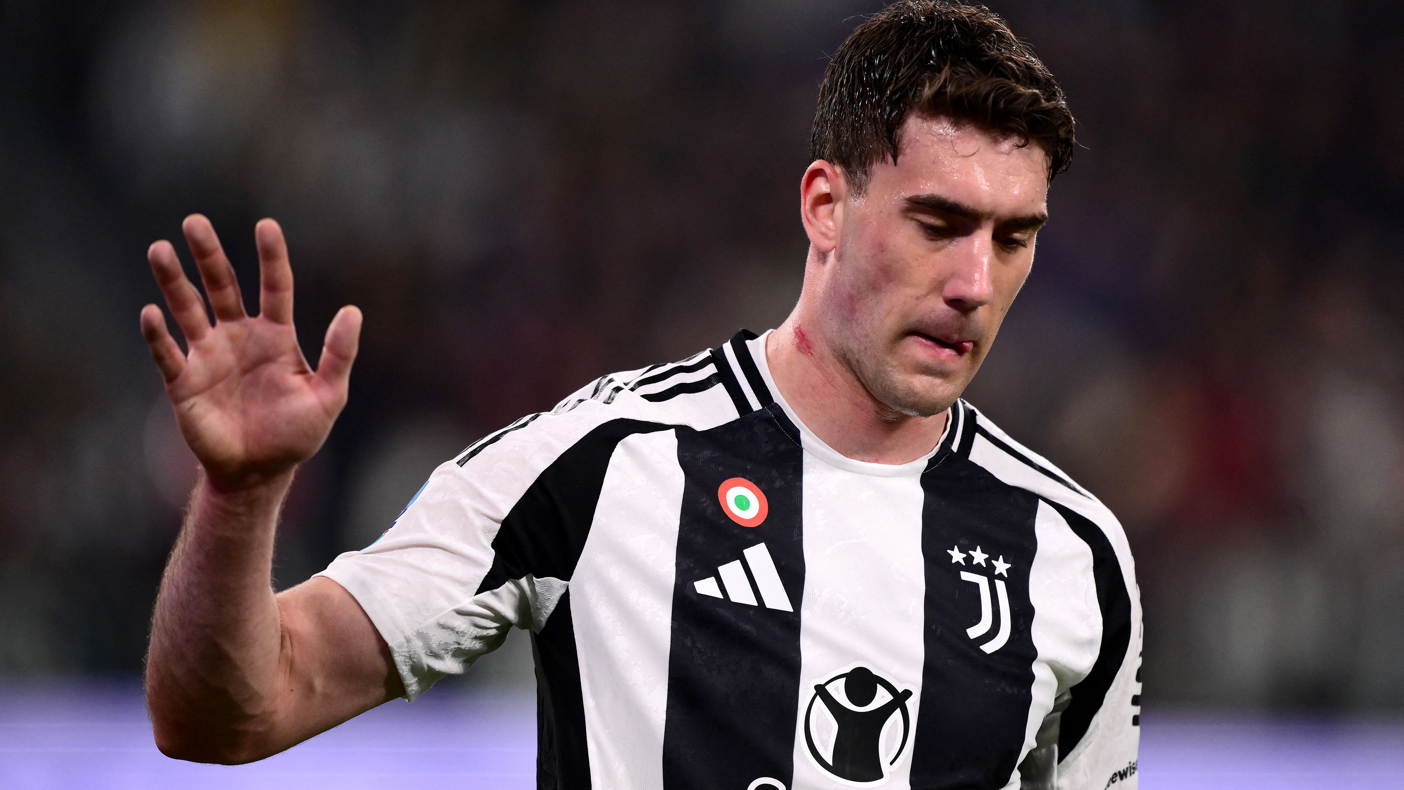 FBL-ITA-SERIE A-JUVENTUS-LECCE