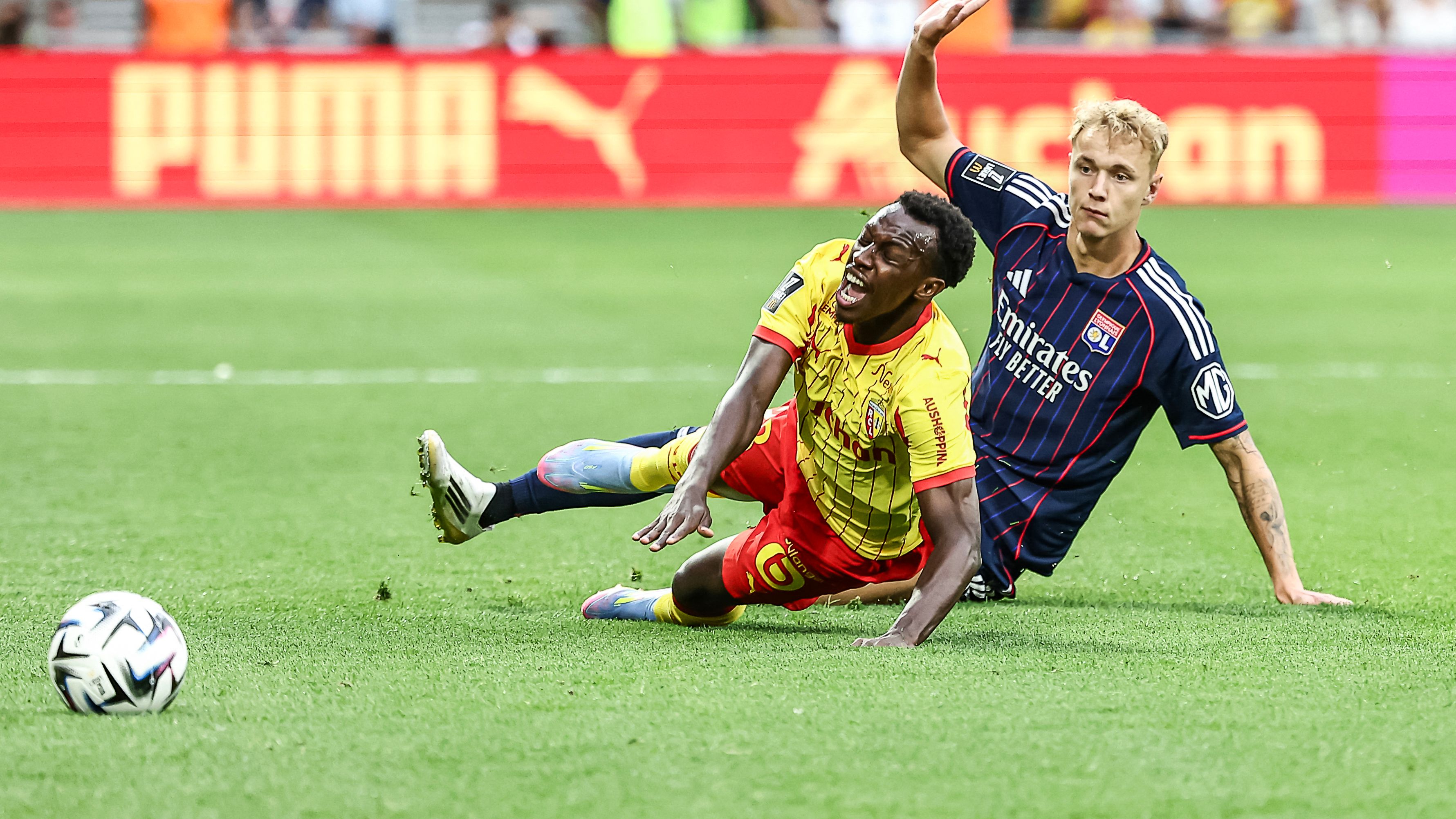 FBL-FRA-LIGUE1-LENS-LYON