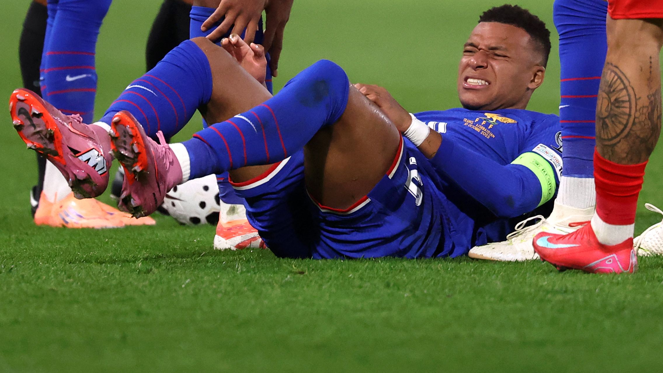 إصابة مبابي