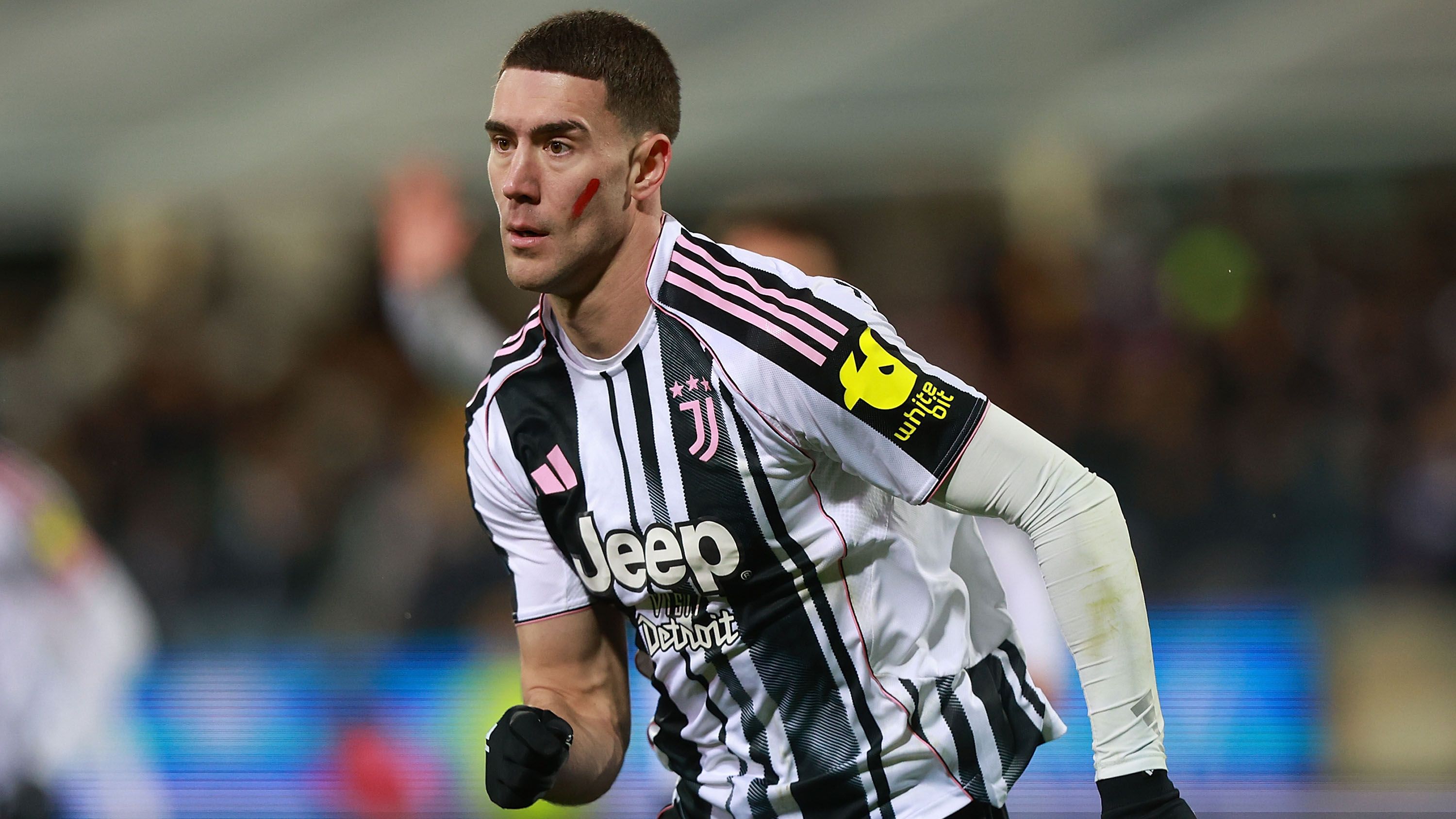 ACF Fiorentina v Juventus FC - Serie A