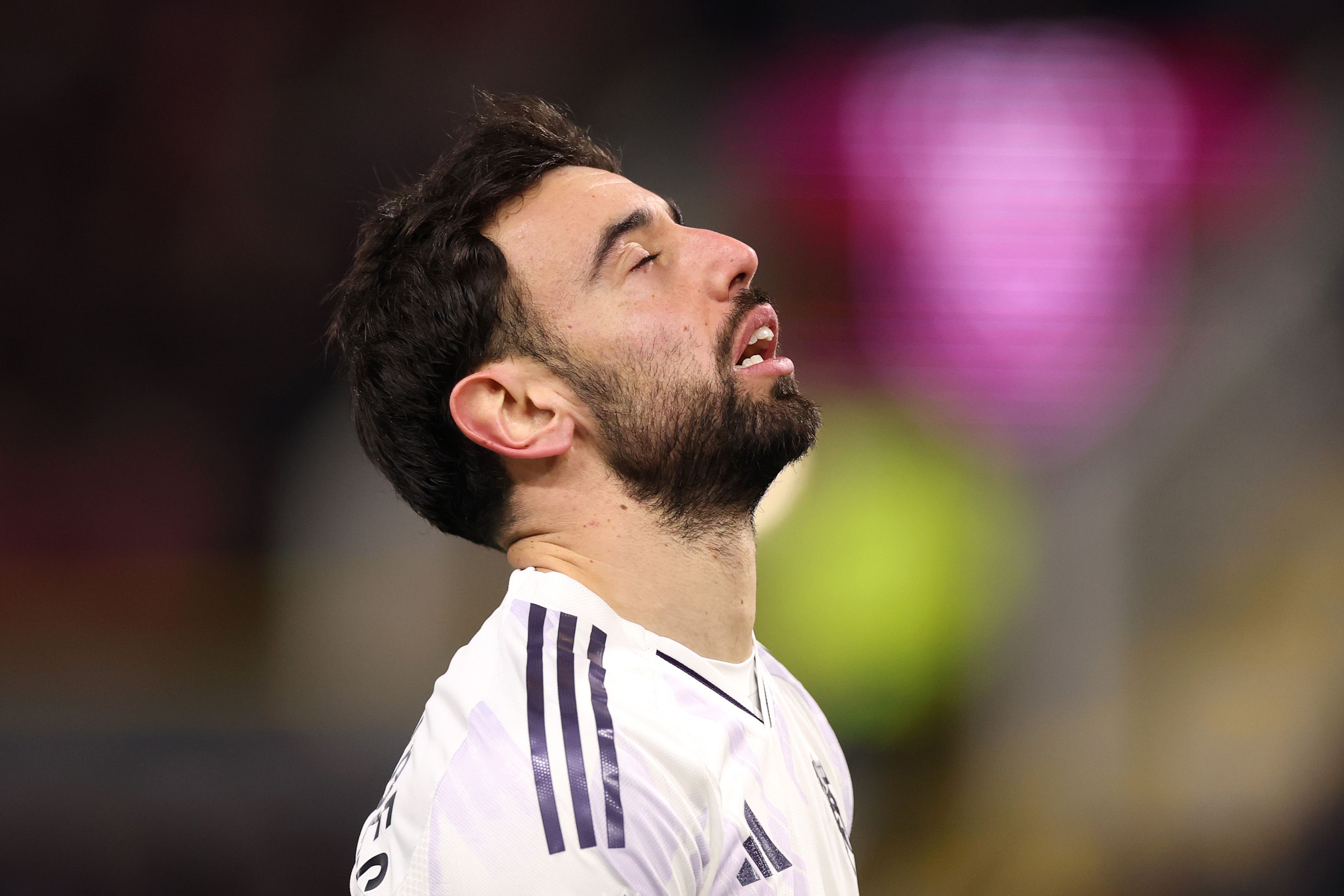 Burnley v Manchester United - Premier League