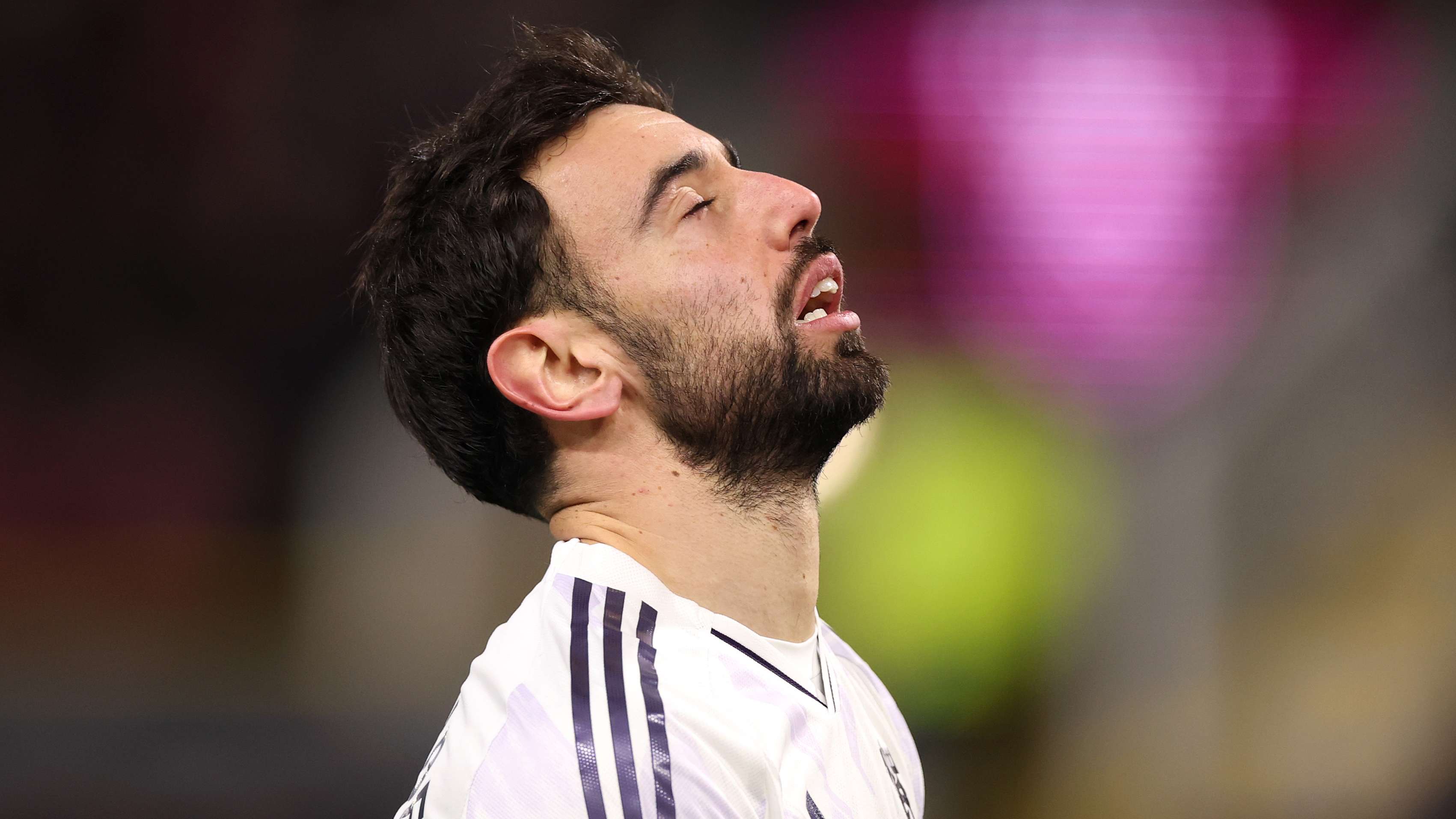 Burnley v Manchester United - Premier League