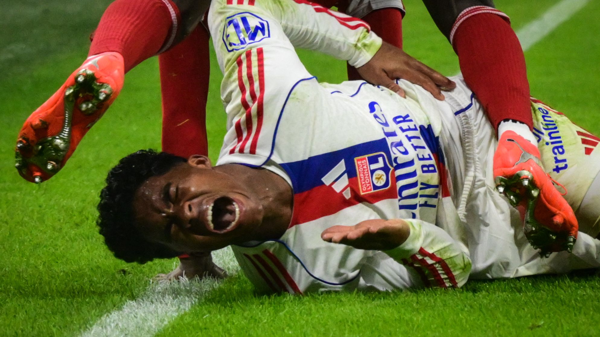 FBL-FRA-LIGUE1-LYON-BREST