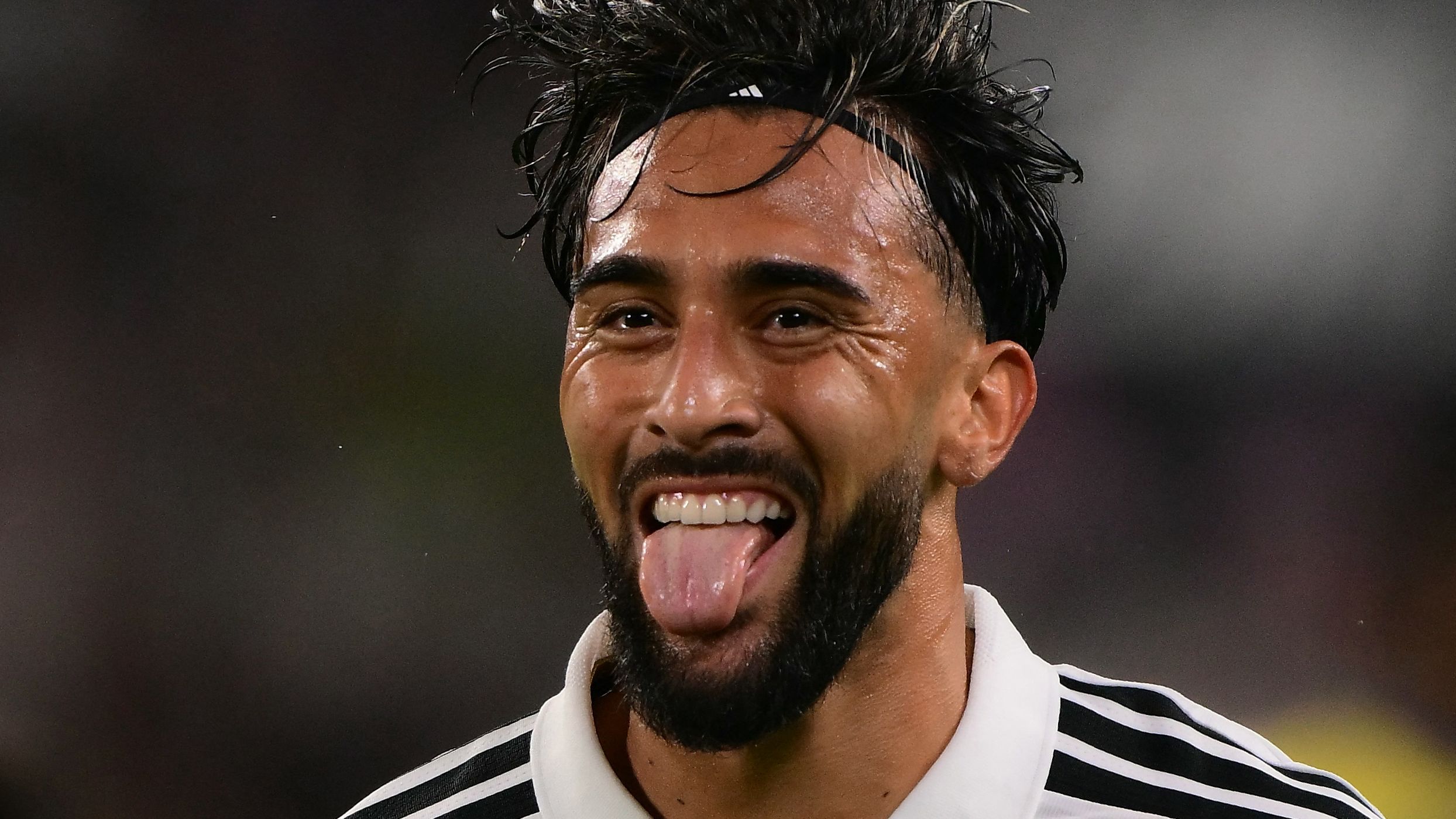 FBL-ITA-SERIE A-JUVENTUS-PARMA