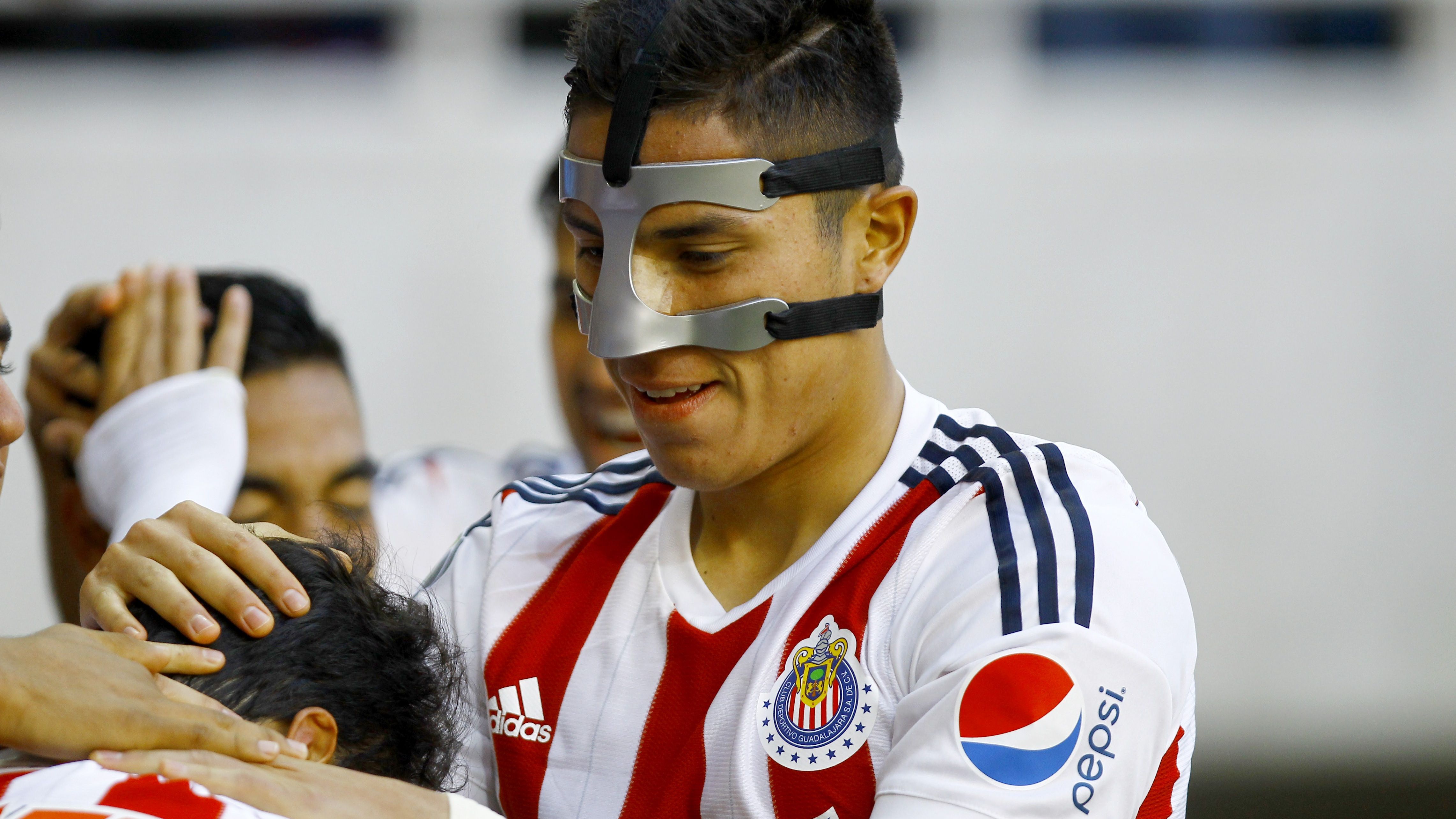 FBL-CHIVAS-TOLUCA-MEXICO