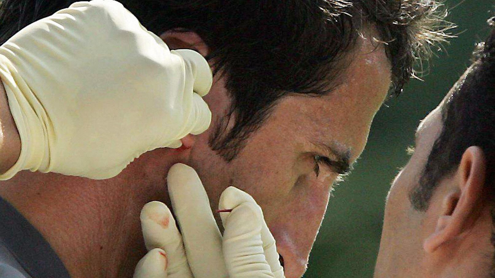 A doctor takes some blood from Werder Br