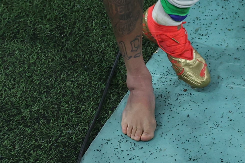 Neymar Ankle 2022