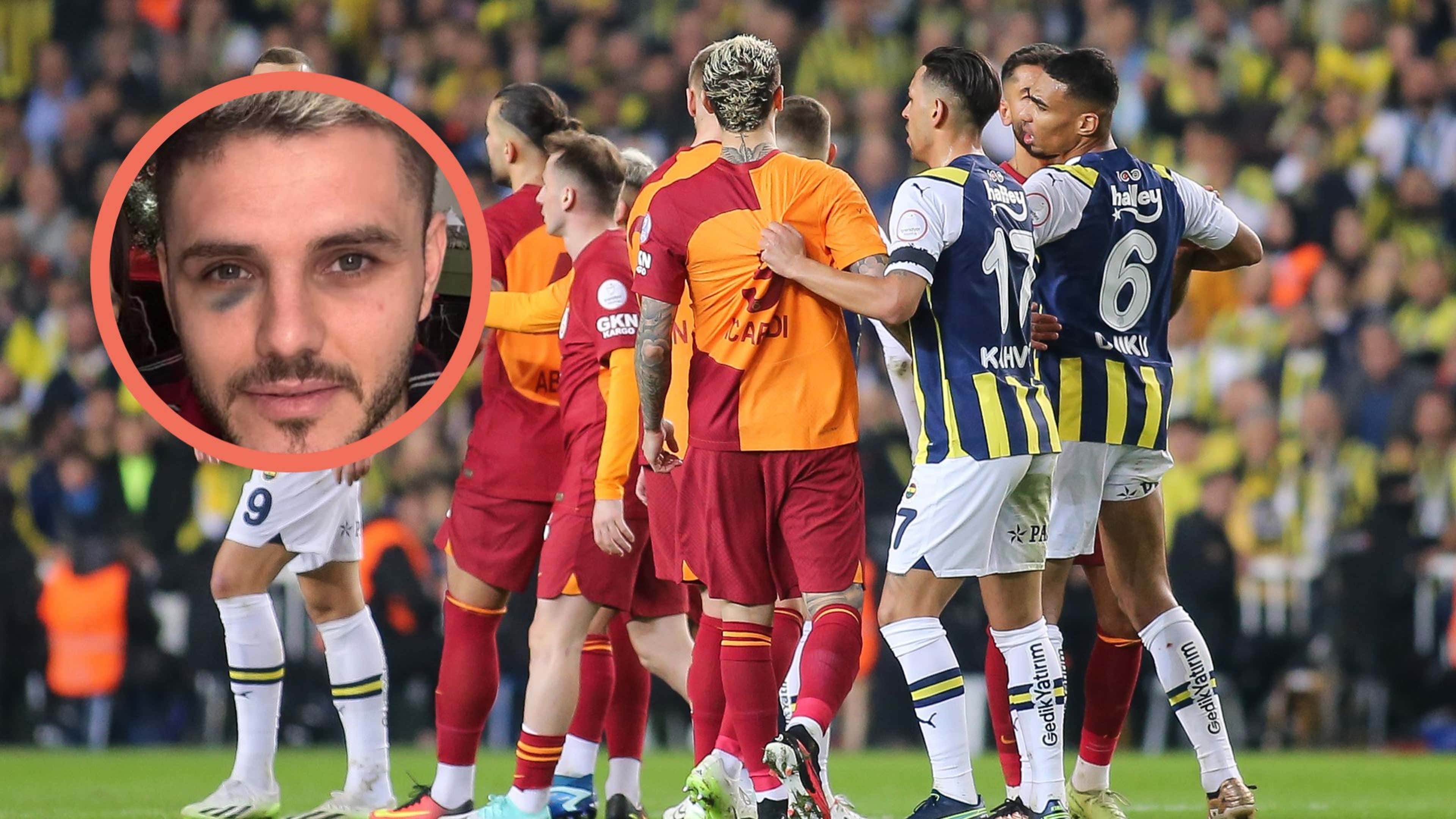 Wir schämen uns für sie: Galatasaray und Fenerbahce liefern sich  öffentlichen Schlagabtausch wegen Icardi-Veilchen